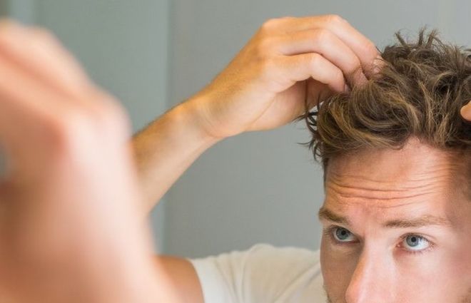 Man bekijkt zijn haarlijn in de spiegel